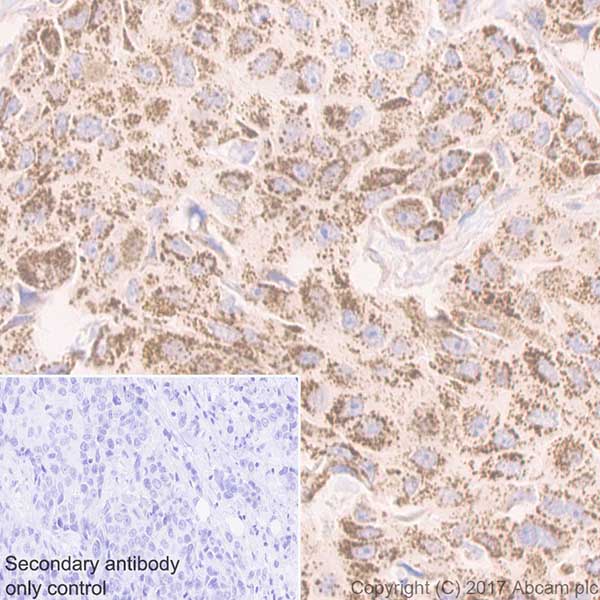 Immunohistochemistry (Formalin/PFA-fixed paraffin-embedded sections) - Anti-Beclin 1 antibody [EPR20473] - BSA and Azide free (AB232461), expandable thumbnail