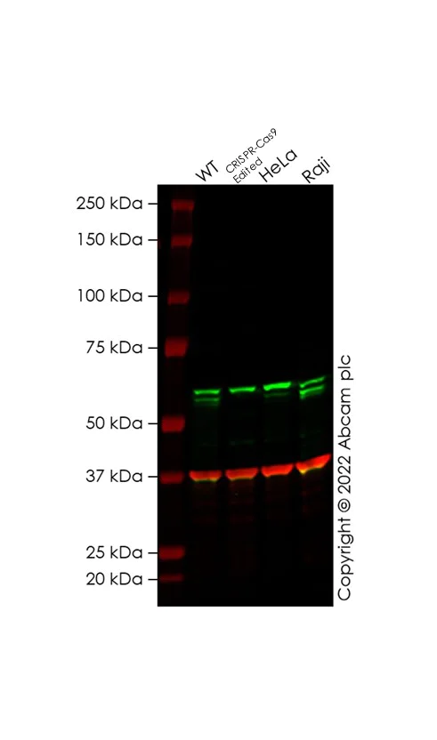 Western blot - Anti-Beclin 1 antibody [OTI4A10] (AB118148)