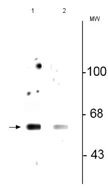 Western blot - Anti-Beclin 1 (phospho S234) antibody (AB183335), expandable thumbnail