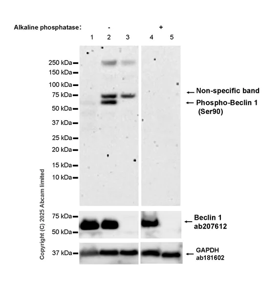 Western blot - Anti-Beclin-1 (phospho S90) antibody [EPR26903-61R] - BSA and Azide free (AB325248)