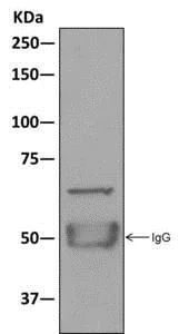 Immunoprecipitation - Anti-BEGAIN antibody [EPR11155] (AB172619)