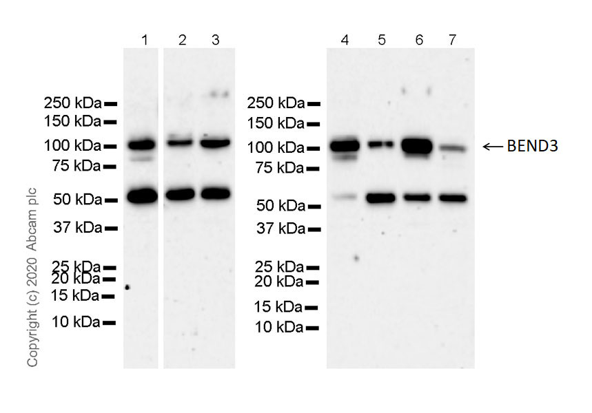 Western blot - Anti-BEND3 antibody [EPR21038-60] - BSA and Azide free (AB273577), expandable thumbnail