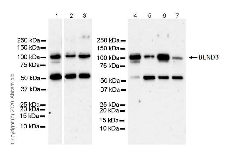 Western blot - Anti-BEND3 antibody [EPR21038-60] - BSA and Azide free (AB273577)