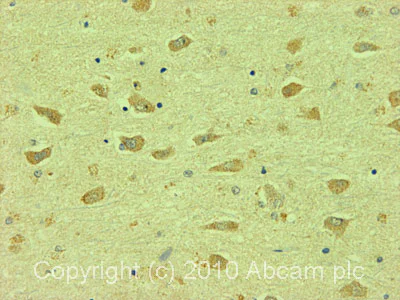 Immunohistochemistry (Formalin/PFA-fixed paraffin-embedded sections) - Anti-Bestrophin/BEST1 antibody (AB14929)