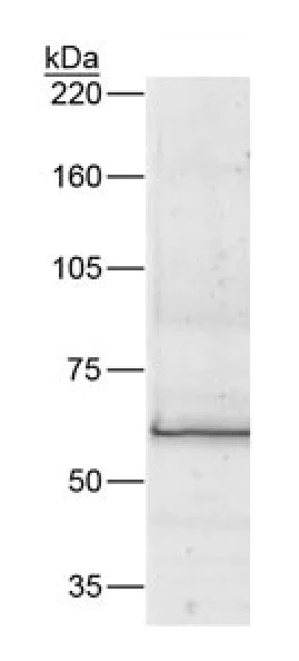 Western blot - Anti-Bestrophin/BEST1 antibody [E6-6] (AB2182)