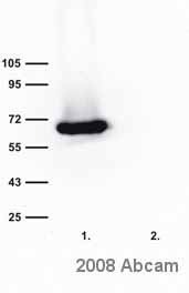 Western blot - Anti-Bestrophin/BEST1 antibody [E6-6] (AB2182)