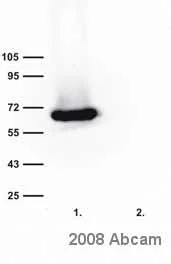 Western blot - Anti-Bestrophin/BEST1 antibody [E6-6] (AB2182)
