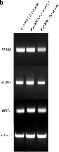 Western blot - Anti-Bestrophin/BEST1 antibody [E6-6] (AB2182)