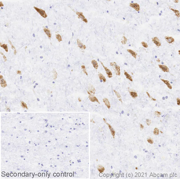 Immunohistochemistry (Frozen sections) - Anti-Bestrophin/BEST1 antibody [EPR23926-112] (AB259836)