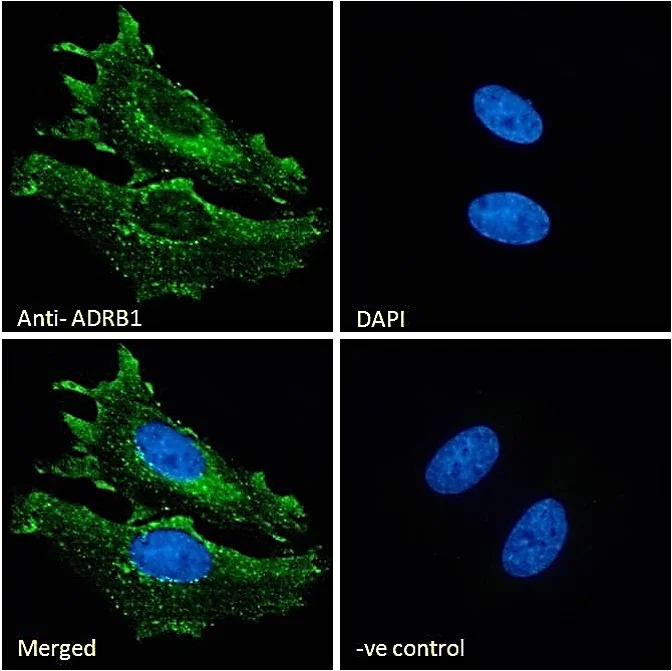 Immunocytochemistry/ Immunofluorescence - Anti-beta 1 Adrenergic Receptor antibody (AB77189)