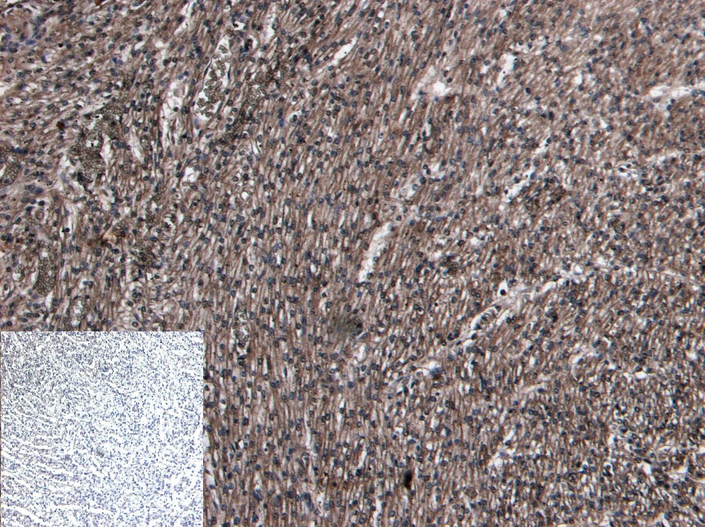 Immunohistochemistry (Formalin/PFA-fixed paraffin-embedded sections) - Anti-beta 1 Adrenergic Receptor antibody (AB77189)