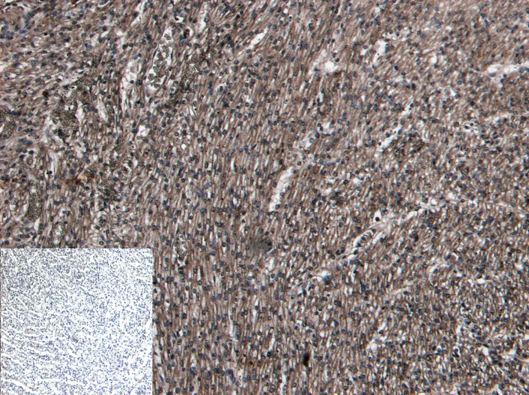 Immunohistochemistry (Formalin/PFA-fixed paraffin-embedded sections) - Anti-beta 1 Adrenergic Receptor antibody (AB77189)