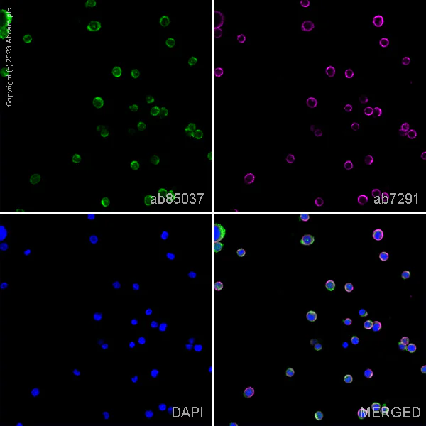 Immunocytochemistry/ Immunofluorescence - Anti-beta 1 Adrenergic Receptor antibody (AB85037)