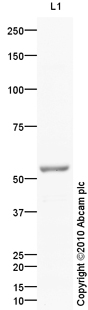 Western blot - Anti-beta 1 Adrenergic Receptor antibody (AB85037), expandable thumbnail