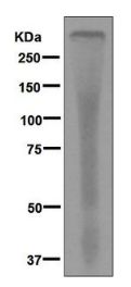 Western blot - Anti-beta 1 Spectrin antibody [EPR6259] - BSA and Azide free (AB248275), expandable thumbnail