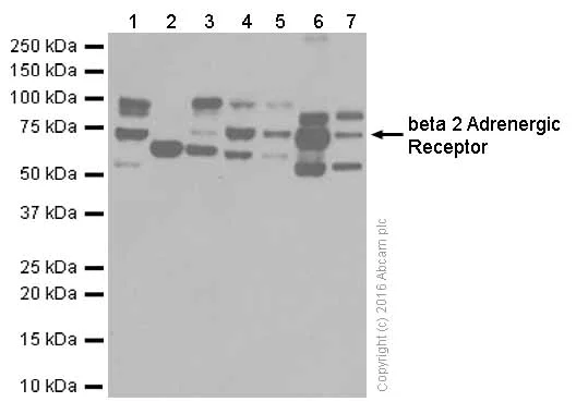Western blot - Anti-beta 2 Adrenergic Receptor antibody [EPR707(N)] (AB182136)