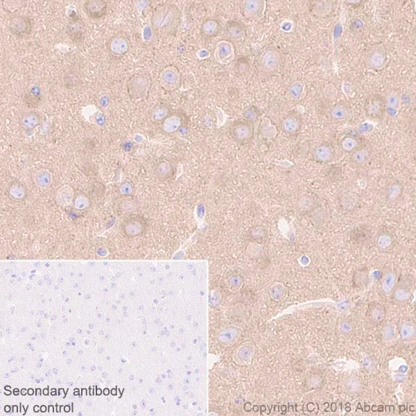 Immunohistochemistry (Formalin/PFA-fixed paraffin-embedded sections) - Anti-beta 2 Adrenergic Receptor antibody [EPR707(N)] - BSA and Azide free (AB213651)