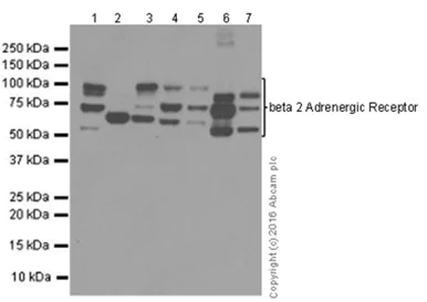 Western blot - Anti-beta 2 Adrenergic Receptor antibody [EPR707(N)] - BSA and Azide free (AB213651)