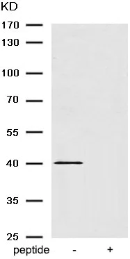 Western blot - Anti-beta 2 Adrenergic Receptor (phospho S346) antibody (AB192821)