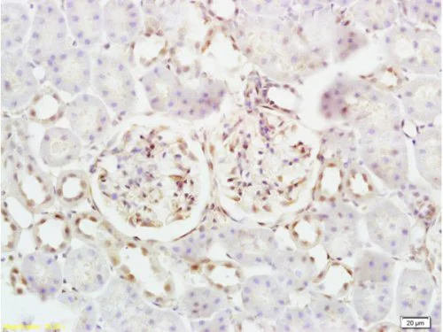Immunohistochemistry (Formalin/PFA-fixed paraffin-embedded sections) - Anti-beta 2 Defensin/BD-2 antibody (AB203077)