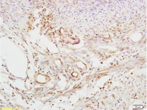 Immunohistochemistry (Formalin/PFA-fixed paraffin-embedded sections) - Anti-beta 2 Defensin/BD-2 antibody (AB203077)