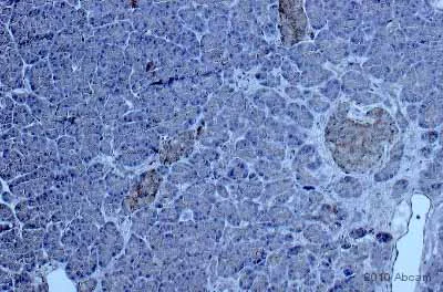 Immunohistochemistry (Formalin/PFA-fixed paraffin-embedded sections) - Anti-beta 2 Defensin/BD-2 antibody (AB63982)