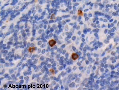 Immunohistochemistry (Formalin/PFA-fixed paraffin-embedded sections) - Anti-beta 2 Defensin/BD-2 antibody (AB63982)