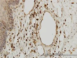 Immunohistochemistry (Formalin/PFA-fixed paraffin-embedded sections) - Anti-beta 2 Microglobulin antibody [3F9-2C2] (AB54810)