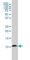 Western blot - Anti-beta 2 Microglobulin antibody [3F9-2C2] (AB54810)