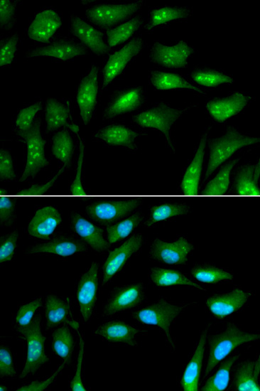 Immunocytochemistry/ Immunofluorescence - Anti-beta 2 Microglobulin antibody (AB175031), expandable thumbnail