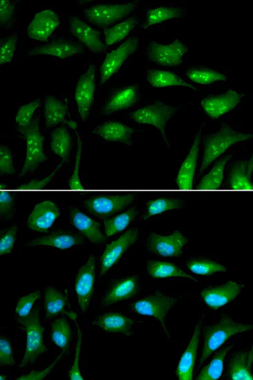 Immunocytochemistry/ Immunofluorescence - Anti-beta 2 Microglobulin antibody (AB175031)