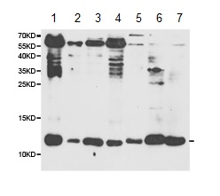 Western blot - Anti-beta 2 Microglobulin antibody (AB175031), expandable thumbnail