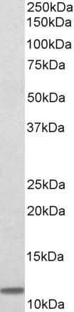 Western blot - Anti-beta 2 Microglobulin antibody (AB223571), expandable thumbnail