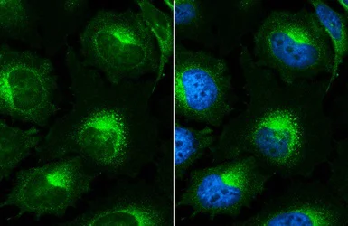 Immunocytochemistry/ Immunofluorescence - Anti-beta 2 Microglobulin antibody (AB227261)