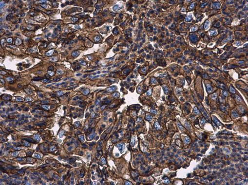 Immunohistochemistry (Formalin/PFA-fixed paraffin-embedded sections) - Anti-beta 2 Microglobulin antibody (AB227261), expandable thumbnail