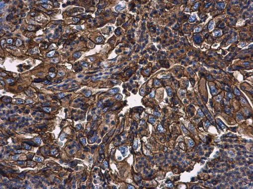 Immunohistochemistry (Formalin/PFA-fixed paraffin-embedded sections) - Anti-beta 2 Microglobulin antibody (AB227261)