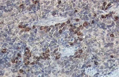 Immunohistochemistry (Formalin/PFA-fixed paraffin-embedded sections) - Anti-beta 2 Microglobulin antibody (AB227261)