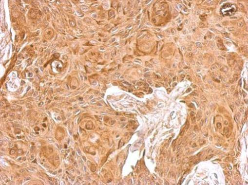 Immunohistochemistry (Formalin/PFA-fixed paraffin-embedded sections) - Anti-beta 2 Microglobulin antibody (AB227261), expandable thumbnail