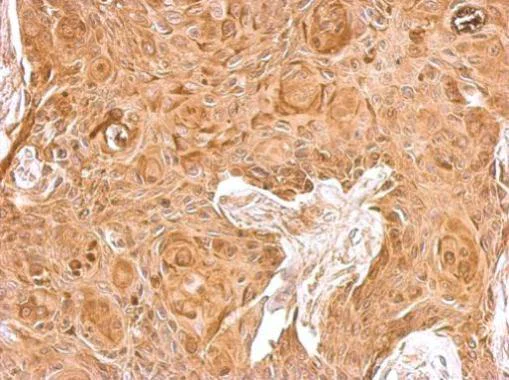 Immunohistochemistry (Formalin/PFA-fixed paraffin-embedded sections) - Anti-beta 2 Microglobulin antibody (AB227261)