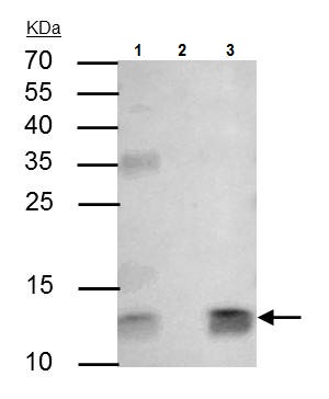 Immunoprecipitation - Anti-beta 2 Microglobulin antibody (AB227261), expandable thumbnail