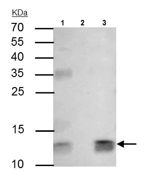 Immunoprecipitation - Anti-beta 2 Microglobulin antibody (AB227261)