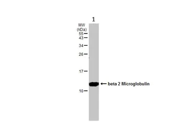 Western blot - Anti-beta 2 Microglobulin antibody (AB227261)
