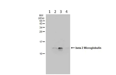 Western blot - Anti-beta 2 Microglobulin antibody (AB227261)