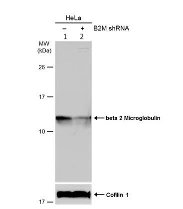 Western blot - Anti-beta 2 Microglobulin antibody (AB227261)