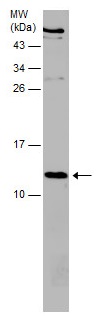 Western blot - Anti-beta 2 Microglobulin antibody (AB227261), expandable thumbnail