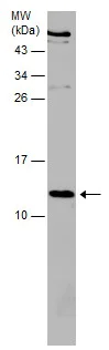 Western blot - Anti-beta 2 Microglobulin antibody (AB227261)