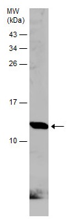 Western blot - Anti-beta 2 Microglobulin antibody (AB227261), expandable thumbnail