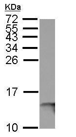 Western blot - Anti-beta 2 Microglobulin antibody (ab227261), expandable thumbnail