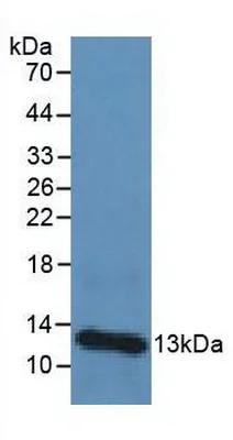 Western blot - Anti-beta 2 Microglobulin antibody (AB231225)