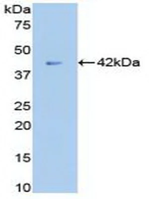 Western blot - Anti-beta 2 Microglobulin antibody (AB231225)